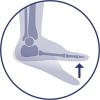 Korekcja biomechaniczna